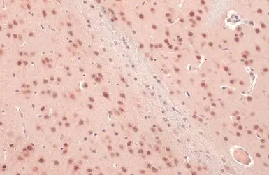 Anti-O-GlcNAc transferase antibody used in IHC (Paraffin sections) (IHC-P). GTX109939