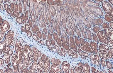 Anti-Villin antibody used in IHC (Paraffin sections) (IHC-P). GTX109940