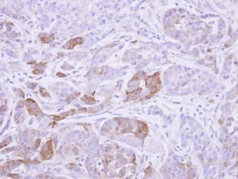 Anti-Villin antibody used in IHC (Paraffin sections) (IHC-P). GTX109940