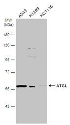 Anti-ATGL antibody [N1C1] used in Western Blot (WB). GTX109941