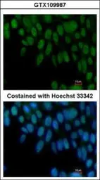 Anti-ZIC3 antibody [N3C3] used in Immunocytochemistry/ Immunofluorescence (ICC/IF). GTX109987