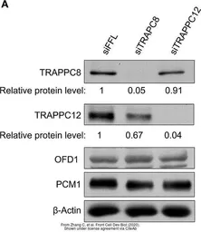 Anti-OFD1 antibody used in Western Blot (WB). GTX110010