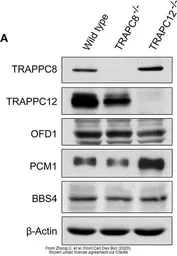 Anti-OFD1 antibody used in Western Blot (WB). GTX110010