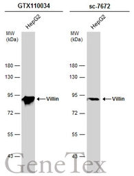 Anti-Villin antibody used in Western Blot (WB). GTX110034