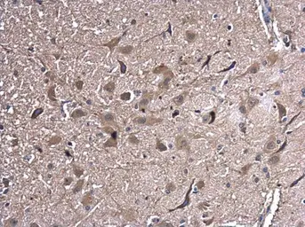 Anti-HSPA2 antibody used in IHC (Paraffin sections) (IHC-P). GTX110079