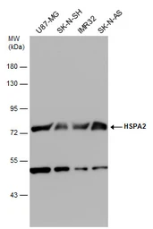 Anti-HSPA2 antibody used in Western Blot (WB). GTX110079