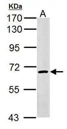 Anti-cIAP1 antibody used in Western Blot (WB). GTX110087