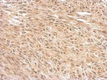 Anti-O-GlcNAc transferase antibody [N1N2], N-term used in IHC (Paraffin sections) (IHC-P). GTX110136