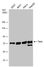 Anti-Tara antibody [C2C3-2], C-term used in Western Blot (WB). GTX110158