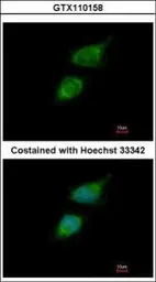 Anti-Tara antibody [C2C3-2], C-term used in Immunocytochemistry/ Immunofluorescence (ICC/IF). GTX110158
