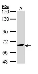Anti-TCP1 epsilon antibody [N1C1] used in Western Blot (WB). GTX110167