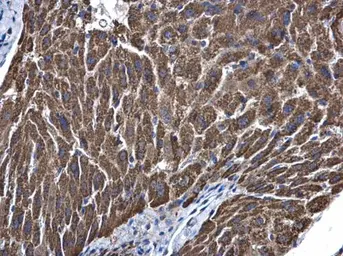 Anti-ALDH5A1 antibody [N1C1] used in IHC (Paraffin sections) (IHC-P). GTX110181