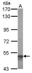 Anti-ALDH5A1 antibody [N1C1] used in Western Blot (WB). GTX110181