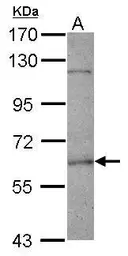 Anti-FANCE antibody [N3C3] used in Western Blot (WB). GTX110184