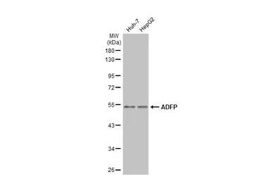 Anti-ADFP antibody [N1C2] used in Western Blot (WB). GTX110204