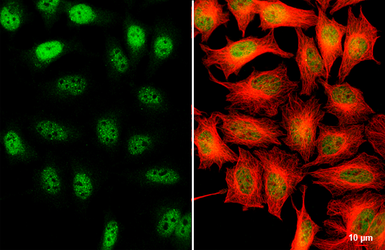 Anti-SETDB1 antibody [N2C1], Internal used in Immunocytochemistry/ Immunofluorescence (ICC/IF). GTX110219