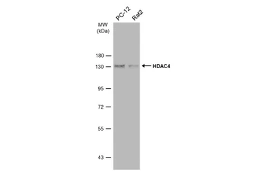 Anti-HDAC4 antibody [N3C1], Internal used in Western Blot (WB). GTX110231