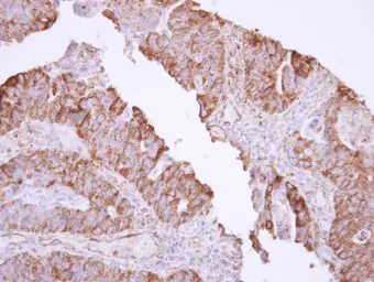 Anti-MX1 antibody [N2C2], Internal used in IHC (Paraffin sections) (IHC-P). GTX110256