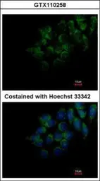 Anti-DMP4 antibody used in Immunocytochemistry/ Immunofluorescence (ICC/IF). GTX110258