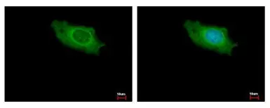 Anti-IKAP antibody [C1C2], Internal used in Immunocytochemistry/ Immunofluorescence (ICC/IF). GTX110274