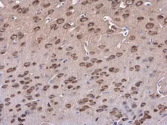 Anti-SAP102 antibody [C1C3] used in IHC (Paraffin sections) (IHC-P). GTX110289