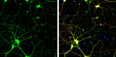 Anti-SAP102 antibody [C1C3] used in Immunocytochemistry/ Immunofluorescence (ICC/IF). GTX110289