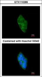 Anti-SAP102 antibody [C1C3] used in Immunocytochemistry/ Immunofluorescence (ICC/IF). GTX110289