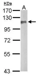 Anti-SAP102 antibody [C1C3] used in Western Blot (WB). GTX110289