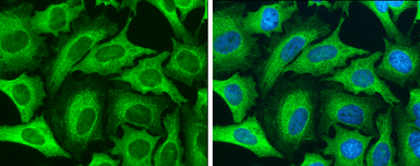 Anti-Cytokeratin 8 antibody used in Immunocytochemistry/ Immunofluorescence (ICC/IF). GTX110311