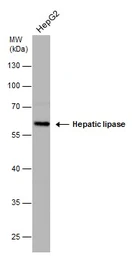 Anti-Hepatic lipase antibody [N1C1] used in Western Blot (WB). GTX110336