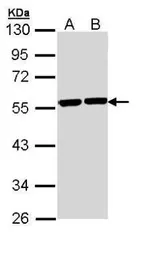 Anti-alpha Tubulin 8 antibody [N1C1-2] used in Western Blot (WB). GTX110432