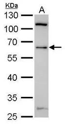 Anti-YY1 antibody used in Western Blot (WB). GTX110442