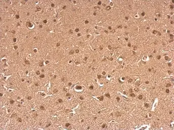 Anti-gamma Synuclein antibody used in IHC (Paraffin sections) (IHC-P). GTX110483