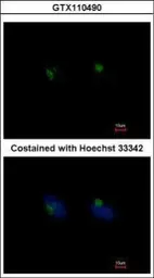 Anti-RGS11 antibody [N2C1], Internal used in Immunocytochemistry/ Immunofluorescence (ICC/IF). GTX110490