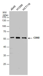 Anti-CDK8 antibody [C3], C-term used in Western Blot (WB). GTX110495