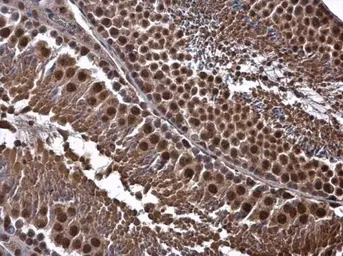 Anti-CDK8 antibody [C3], C-term used in IHC (Paraffin sections) (IHC-P). GTX110495