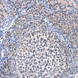 Anti-SMYD5 antibody [C2C3], C-term used in IHC (Paraffin sections) (IHC-P). GTX110518
