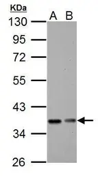 Anti-IKB alpha antibody used in Western Blot (WB). GTX110521