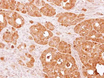 Anti-PSAT1 antibody [N1C3] used in IHC (Paraffin sections) (IHC-P). GTX110576