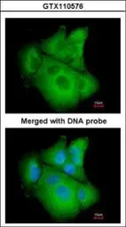 Anti-PSAT1 antibody [N1C3] used in Immunocytochemistry/ Immunofluorescence (ICC/IF). GTX110576