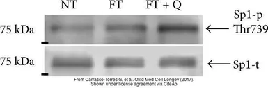 Anti-SP1 antibody used in Western Blot (WB). GTX110593