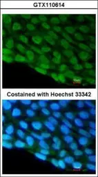 Anti-DDX3 antibody [N3C2], Internal used in Immunocytochemistry/ Immunofluorescence (ICC/IF). GTX110614