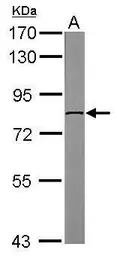 Anti-DDX3 antibody [N3C2], Internal used in Western Blot (WB). GTX110614