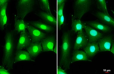 Anti-DDX3 antibody [N3C2], Internal used in Immunocytochemistry/ Immunofluorescence (ICC/IF). GTX110614