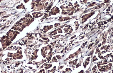 Anti-DDX3 antibody [N3C2], Internal used in IHC (Paraffin sections) (IHC-P). GTX110614