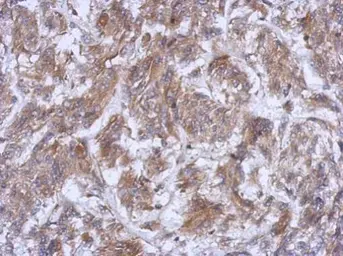 Anti-ATG16L1 antibody [N2C1], Internal used in IHC (Paraffin sections) (IHC-P). GTX110619