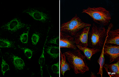 Anti-Citrate synthase antibody [N2C3] used in Immunocytochemistry/ Immunofluorescence (ICC/IF). GTX110624