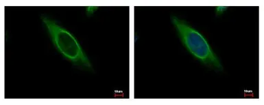 Anti-CAB39 antibody used in Immunocytochemistry/ Immunofluorescence (ICC/IF). GTX110628