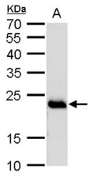 Anti-RAB6A antibody used in Western Blot (WB). GTX110646