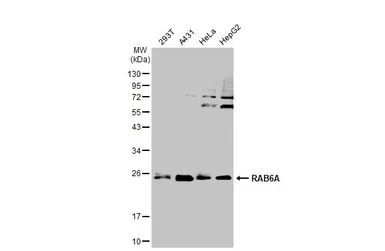 Anti-RAB6A antibody used in Western Blot (WB). GTX110646